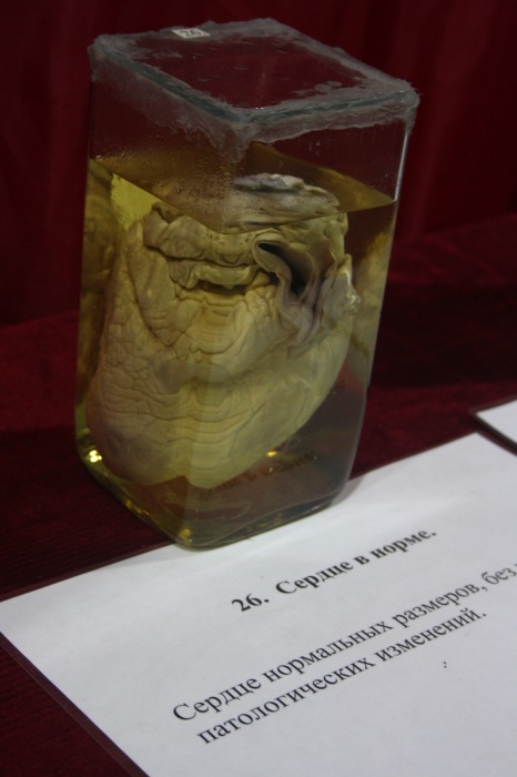 Псков: Петербургская Кунсткамера у нас в гостях. СТРОГО 18 +