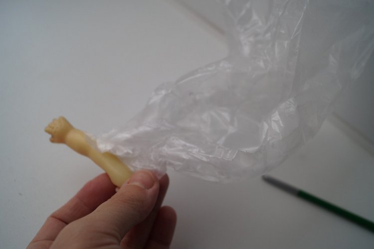 Третья выписка ноября. Лечим перелом колена, ставим донорские ручки. Анжелочка выздоровела + история-воспоминание о детском