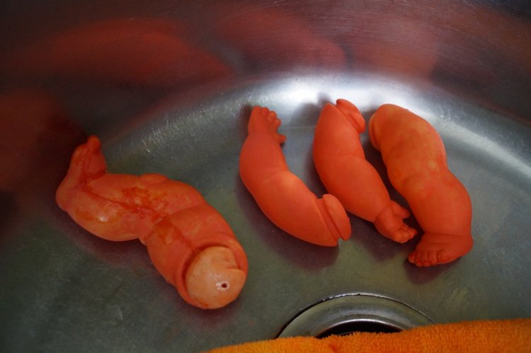 Четвёртая мартовская выписка. Машенька снова бегает и поёт! А перелом ноги исправлен за 10 минут