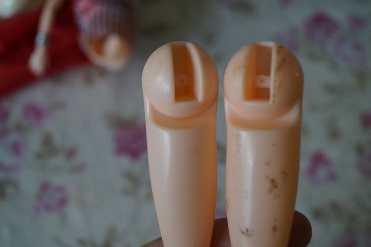 Вторая выписка сентября. Ещё одна поломка тазобедренных суставов и как её легко исправить