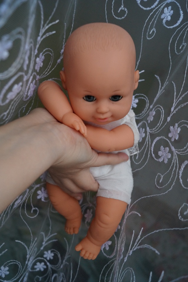 Вторая выписка декабря. Главная героиня нового года поправила своё здоровье. Лечим покусанные руки Барби, удаляем жир с