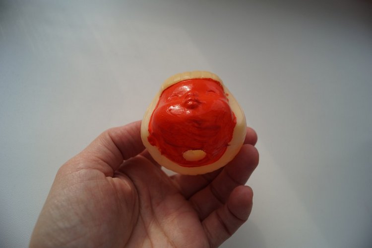 Третья мартовская выписка. Вылечено два перелома