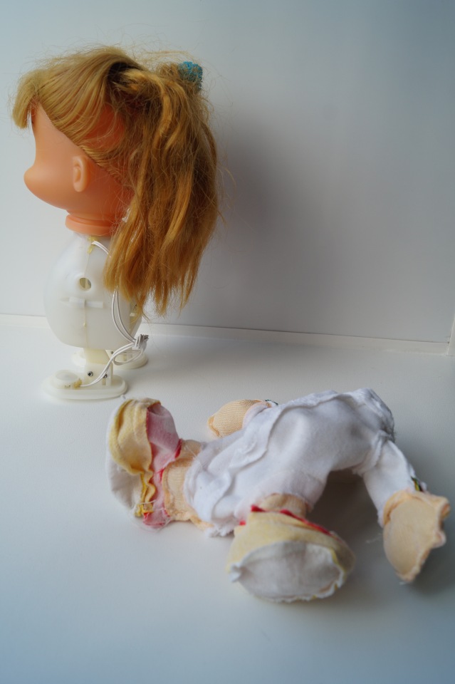 Четвёртая мартовская выписка. Машенька снова бегает и поёт! А перелом ноги исправлен за 10 минут