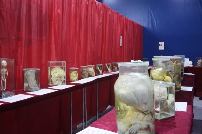 Псков: Петербургская Кунсткамера у нас в гостях. СТРОГО 18 + (фото 4)