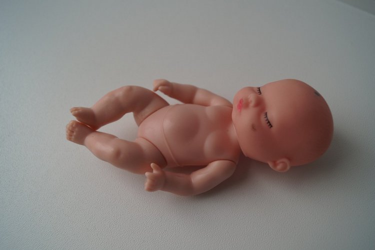 Третья выписка сентября. Перелом колена, сломано крепление руки в плече, сгрызена кисть или полное её отсутствие - это все