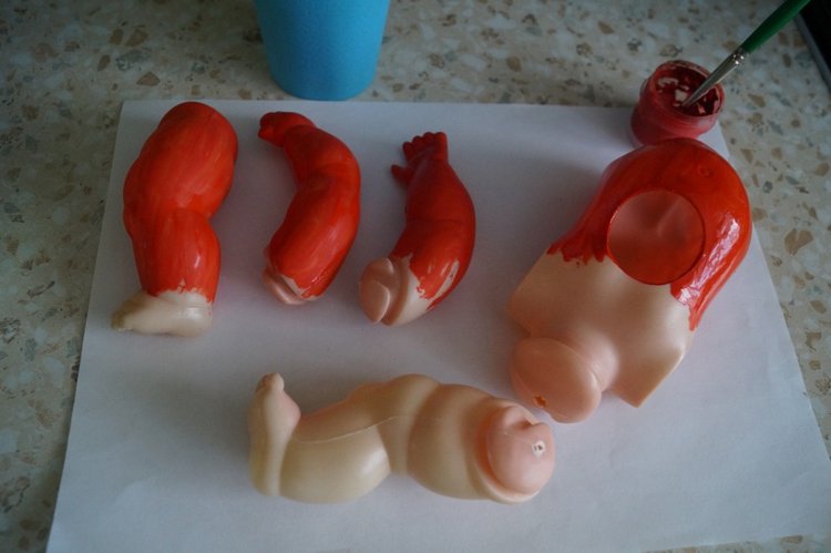 Четвёртая мартовская выписка. Машенька снова бегает и поёт! А перелом ноги исправлен за 10 минут