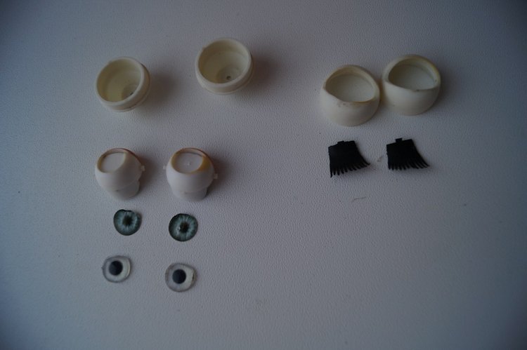 Третья выписка ноября. Лечим перелом колена, ставим донорские ручки. Анжелочка выздоровела + история-воспоминание о детском