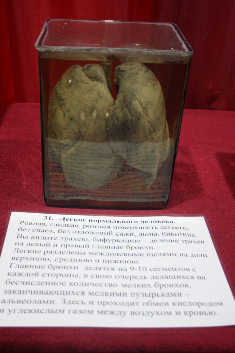 Псков: Петербургская Кунсткамера у нас в гостях. СТРОГО 18 + (фото 8)