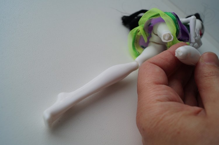 Третья мартовская выписка. Вылечено два перелома (фото 4)