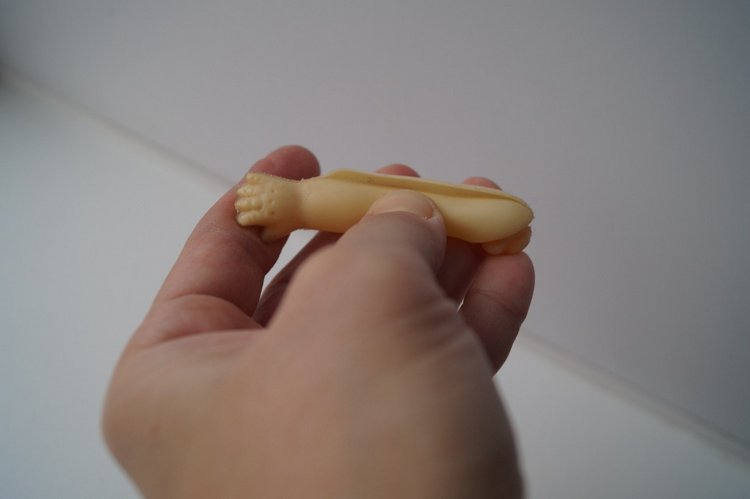 Третья выписка ноября. Лечим перелом колена, ставим донорские ручки. Анжелочка выздоровела + история-воспоминание о детском