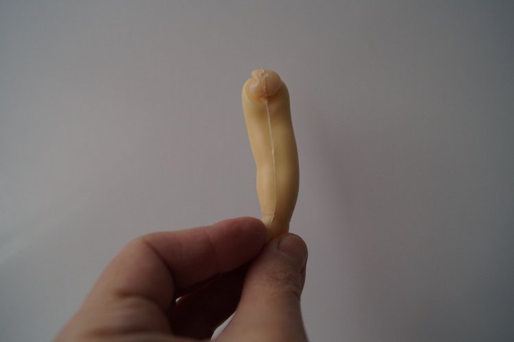 Третья выписка ноября. Лечим перелом колена, ставим донорские ручки. Анжелочка выздоровела + история-воспоминание о детском