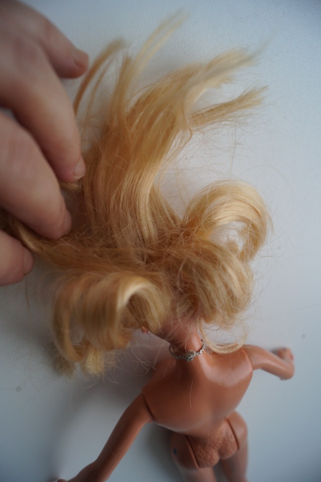 Вторая выписка декабря. Главная героиня нового года поправила своё здоровье. Лечим покусанные руки Барби, удаляем жир с