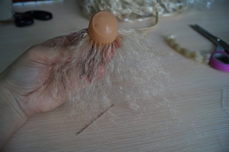 Вторая выписка декабря. Главная героиня нового года поправила своё здоровье. Лечим покусанные руки Барби, удаляем жир с