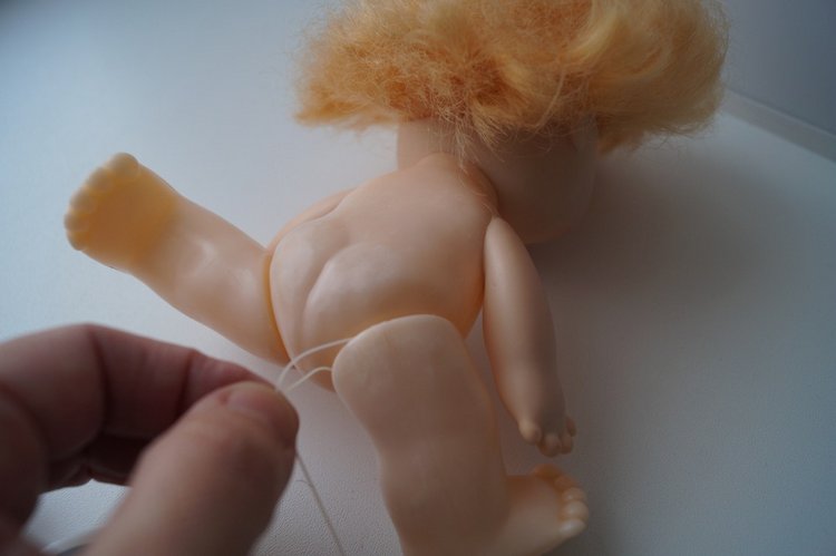 Третья мартовская выписка. Вылечено два перелома