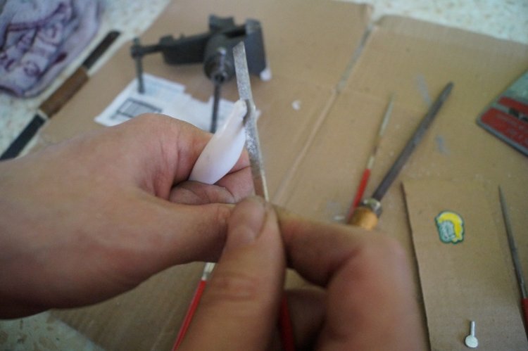 Третья мартовская выписка. Вылечено два перелома (фото 8)