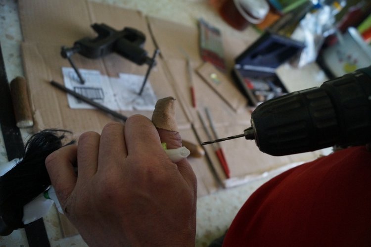 Третья мартовская выписка. Вылечено два перелома