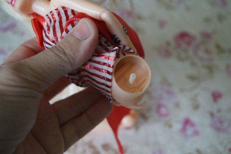 Вторая выписка сентября. Ещё одна поломка тазобедренных суставов и как её легко исправить