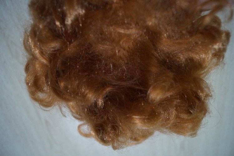 Субботняя выписка! У нейрохирурга снова была пациентка