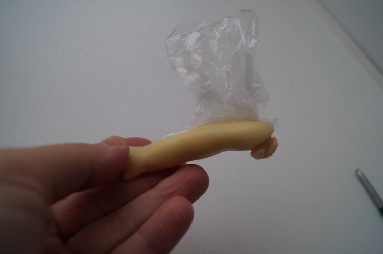 Третья выписка ноября. Лечим перелом колена, ставим донорские ручки. Анжелочка выздоровела + история-воспоминание о детском