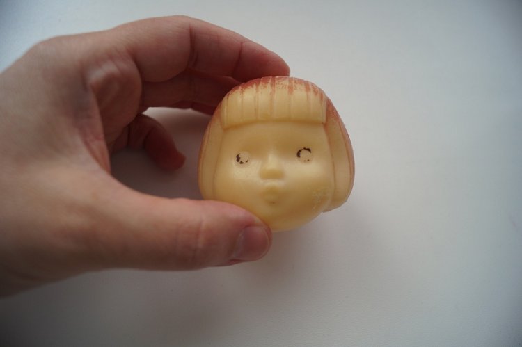 Третья мартовская выписка. Вылечено два перелома