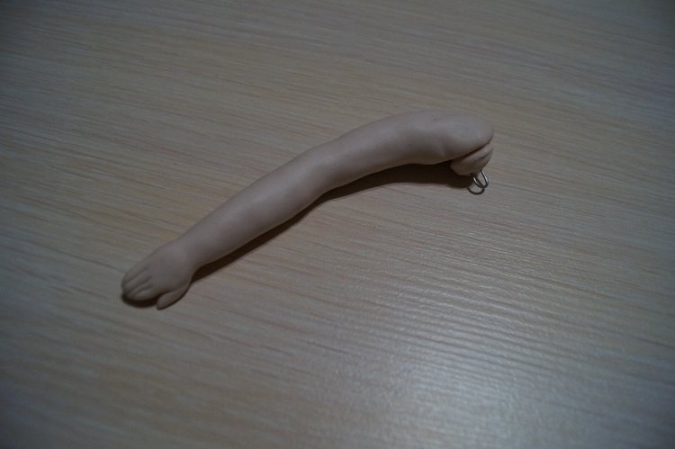 Третья выписка ноября. Лечим перелом колена, ставим донорские ручки. Анжелочка выздоровела + история-воспоминание о детском