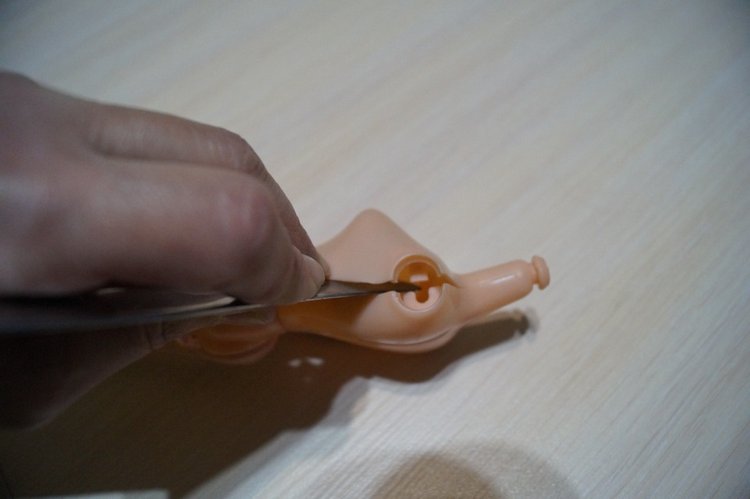 Вторая выписка декабря. Главная героиня нового года поправила своё здоровье. Лечим покусанные руки Барби, удаляем жир с