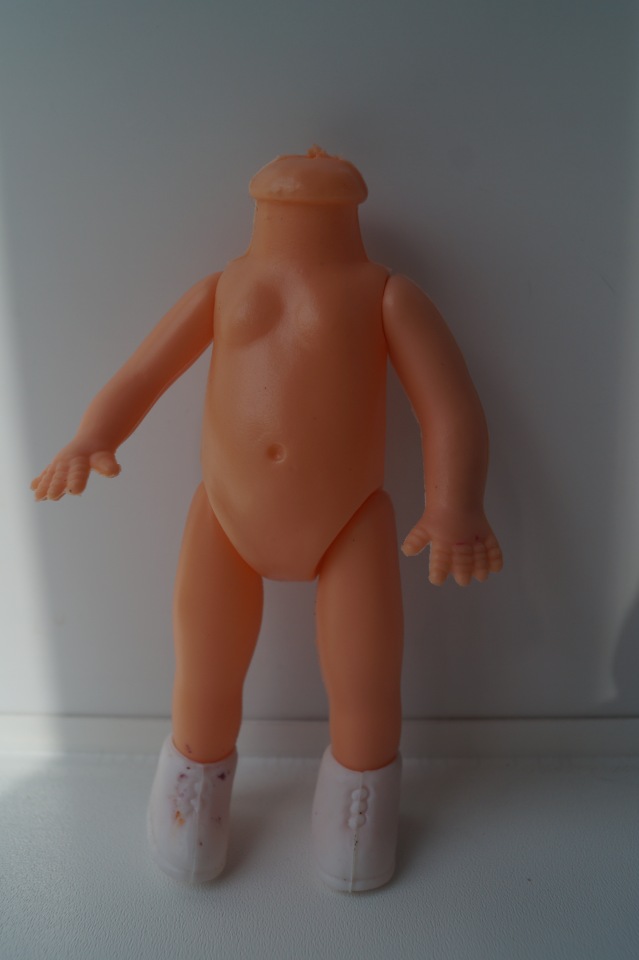 Вторая выписка сентября. Ещё одна поломка тазобедренных суставов и как её легко исправить