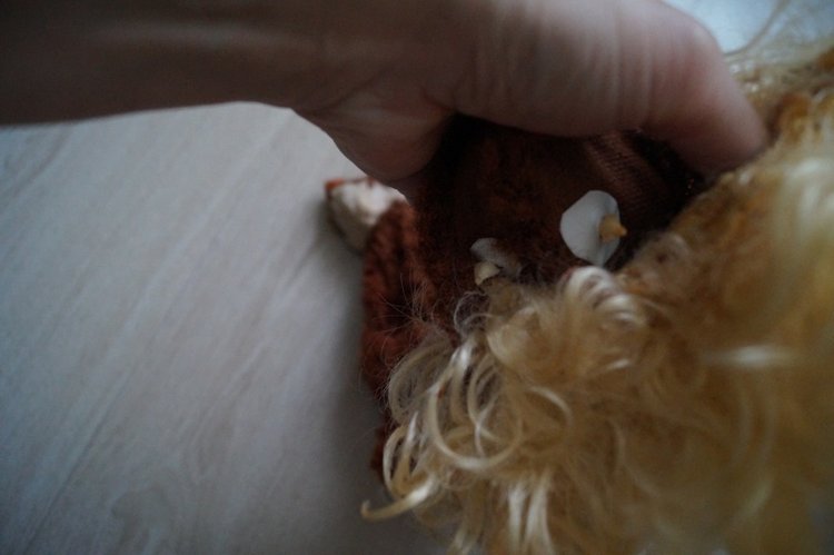 Субботняя выписка! У нейрохирурга снова была пациентка