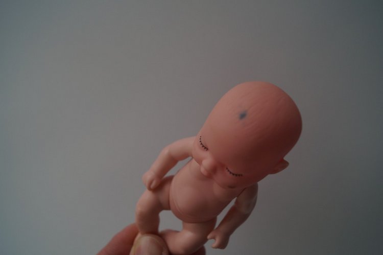 Третья выписка сентября. Перелом колена, сломано крепление руки в плече, сгрызена кисть или полное её отсутствие - это все