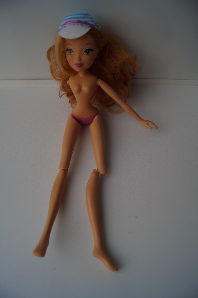 Третья выписка ноября. Лечим перелом колена, ставим донорские ручки. Анжелочка выздоровела + история-воспоминание о детском