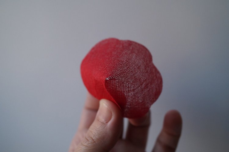 Четвёртая мартовская выписка. Машенька снова бегает и поёт! А перелом ноги исправлен за 10 минут