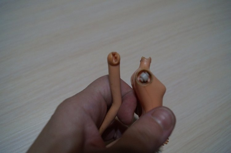 Третья выписка ноября. Лечим перелом колена, ставим донорские ручки. Анжелочка выздоровела + история-воспоминание о детском