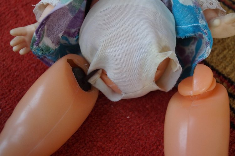 Вторая июльская выписка. Лечение глазок: отсутствие радужки, косоглазие. На лечении была ГДРочка. Голова+тело= красивая