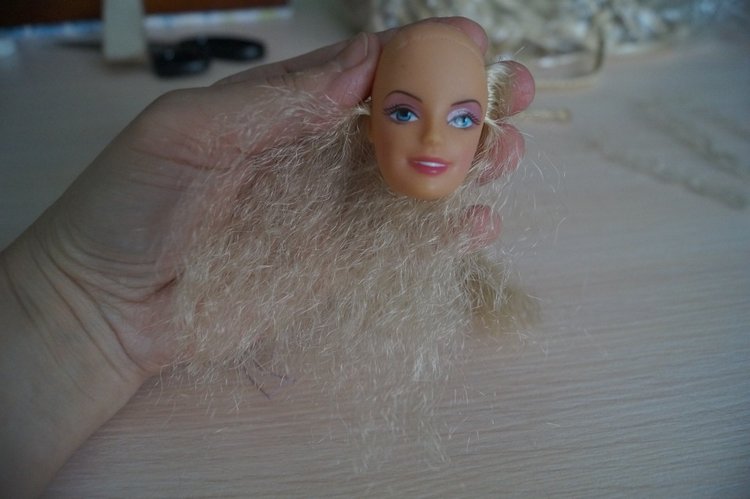 Вторая выписка декабря. Главная героиня нового года поправила своё здоровье. Лечим покусанные руки Барби, удаляем жир с