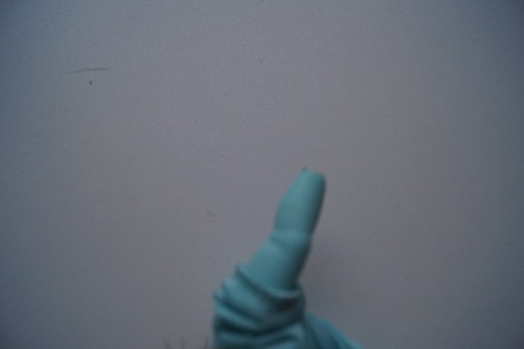 Субботняя выписка! У нейрохирурга снова была пациентка