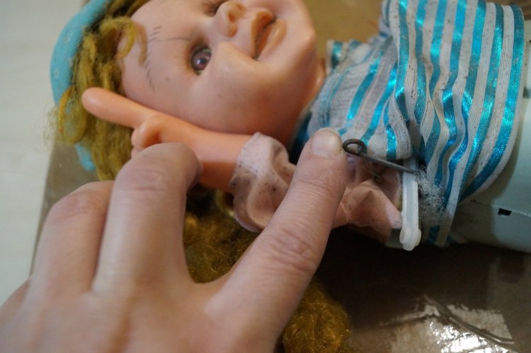 Субботняя выписка! У нейрохирурга снова была пациентка (фото 2)