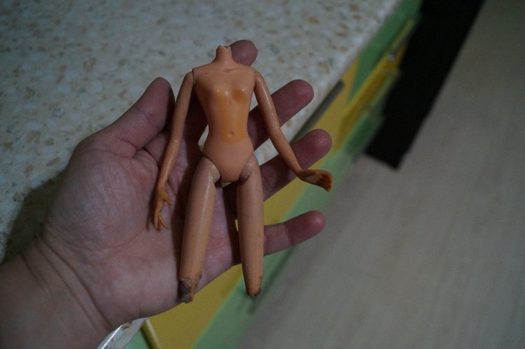 Третья выписка ноября. Лечим перелом колена, ставим донорские ручки. Анжелочка выздоровела + история-воспоминание о детском