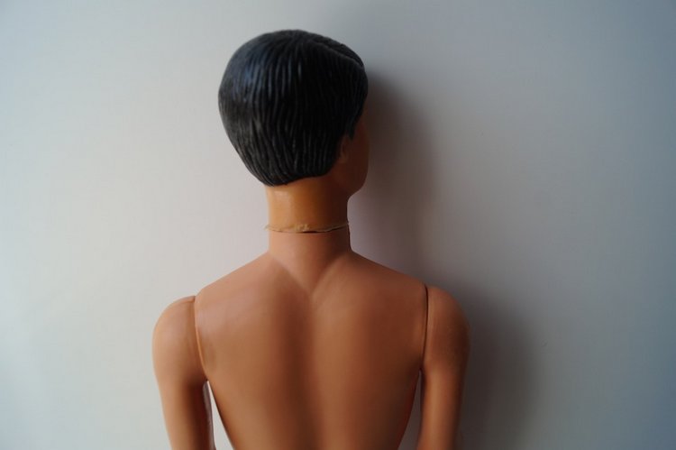 Третья мартовская выписка. Вылечено два перелома