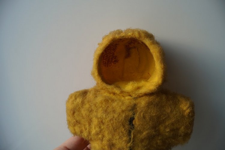 Третья мартовская выписка. Вылечено два перелома