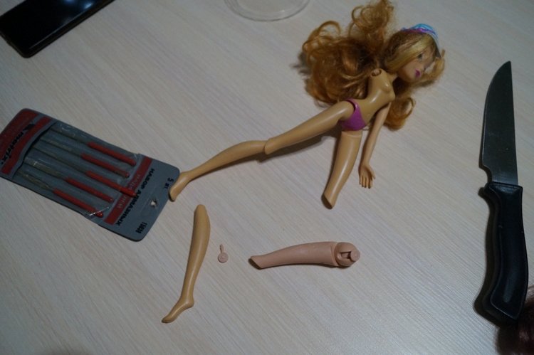 Третья выписка ноября. Лечим перелом колена, ставим донорские ручки. Анжелочка выздоровела + история-воспоминание о детском