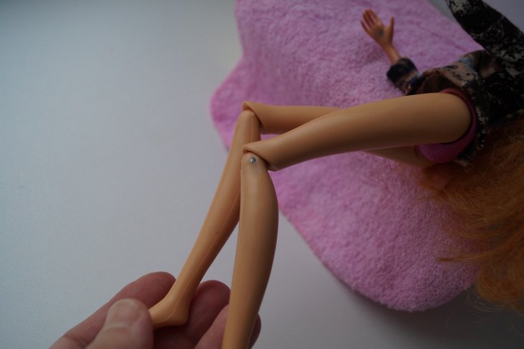 Третья выписка ноября. Лечим перелом колена, ставим донорские ручки. Анжелочка выздоровела + история-воспоминание о детском