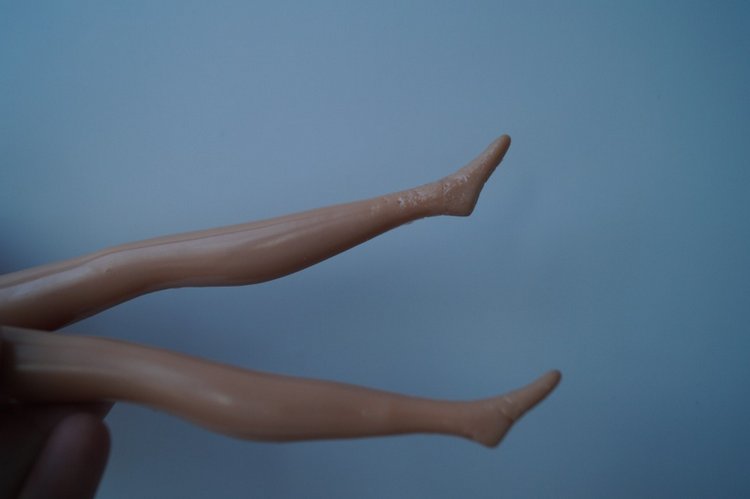 Вторая выписка января. Фарфоровая Снегурочка стала как новенькая. Зайчик снова видит. Как исправить западающий глазик у