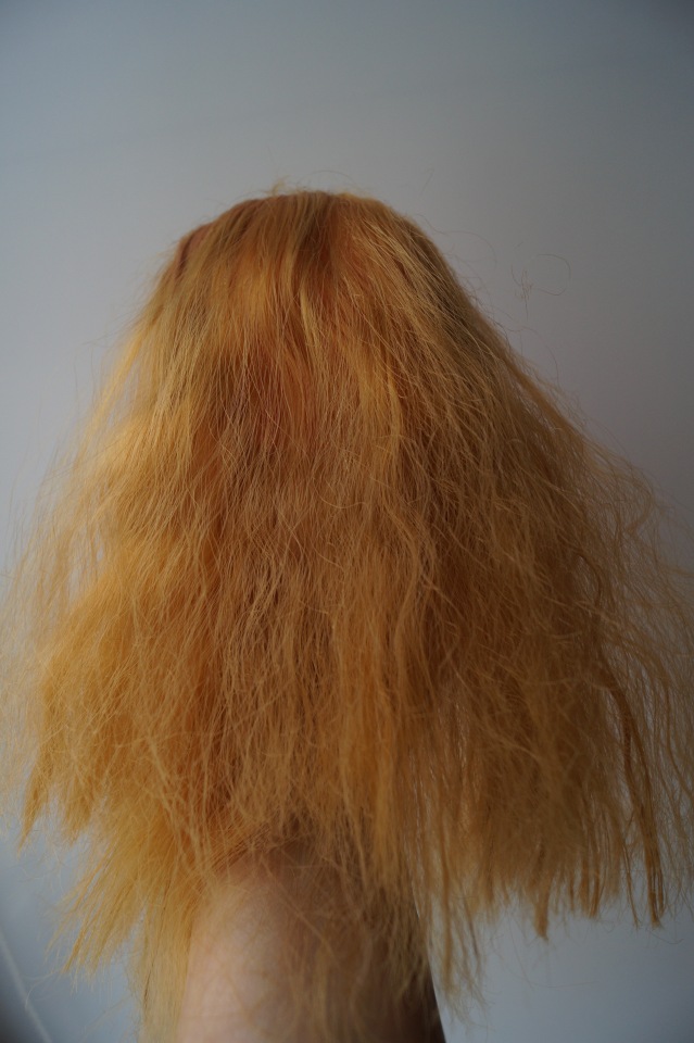 Четвёртая мартовская выписка. Машенька снова бегает и поёт! А перелом ноги исправлен за 10 минут