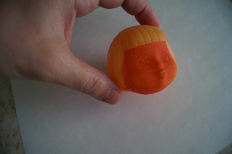 Третья мартовская выписка. Вылечено два перелома