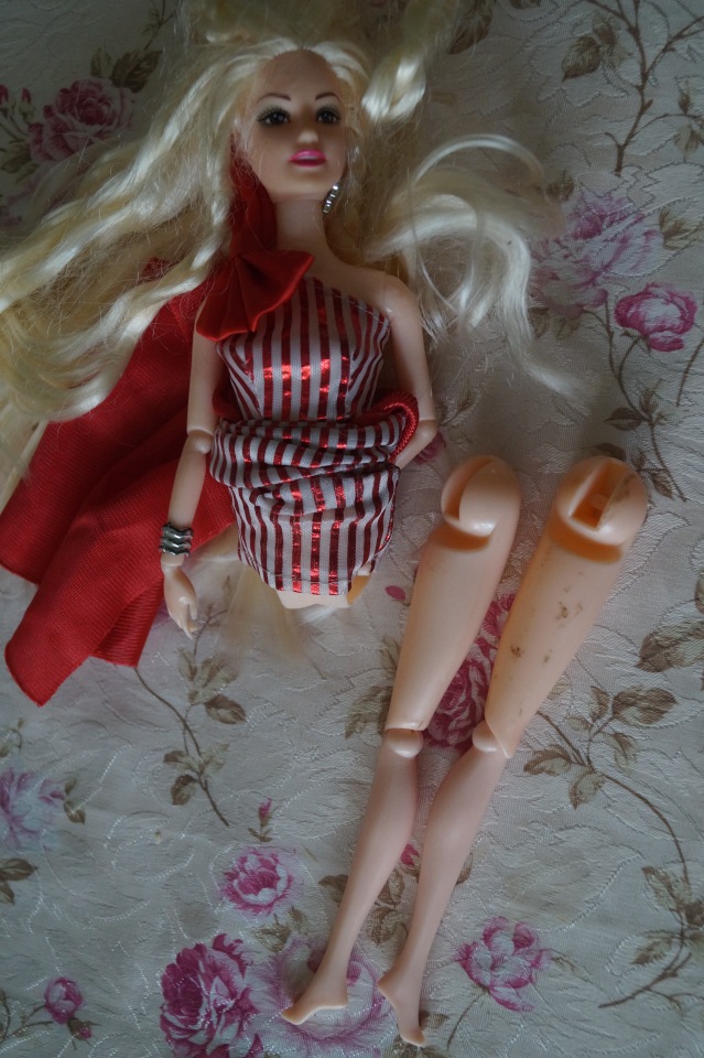 Вторая выписка сентября. Ещё одна поломка тазобедренных суставов и как её легко исправить