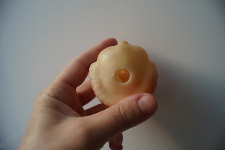 Третья мартовская выписка. Вылечено два перелома