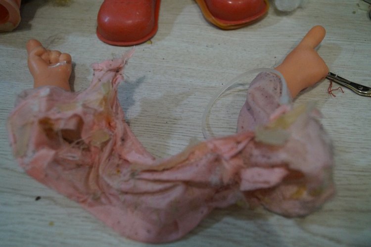 Субботняя выписка! У нейрохирурга снова была пациентка (фото 9)