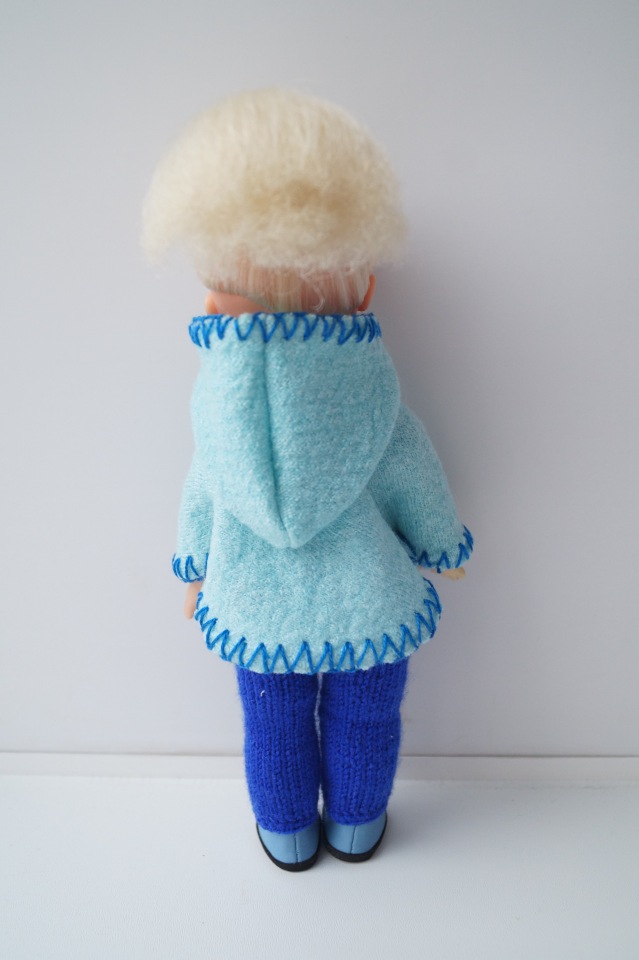 Третья выписка ноября. Лечим перелом колена, ставим донорские ручки. Анжелочка выздоровела + история-воспоминание о детском