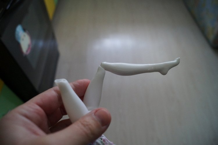 Четвёртая мартовская выписка. Машенька снова бегает и поёт! А перелом ноги исправлен за 10 минут