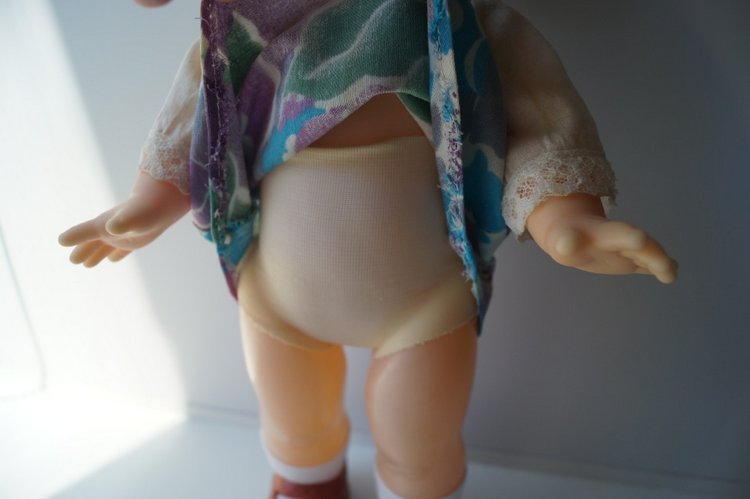 Вторая июльская выписка. Лечение глазок: отсутствие радужки, косоглазие. На лечении была ГДРочка. Голова+тело= красивая